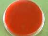 blood-agar-2