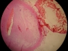 calcification-4-muscles-4x