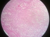 coagulative necrosis-kidney
