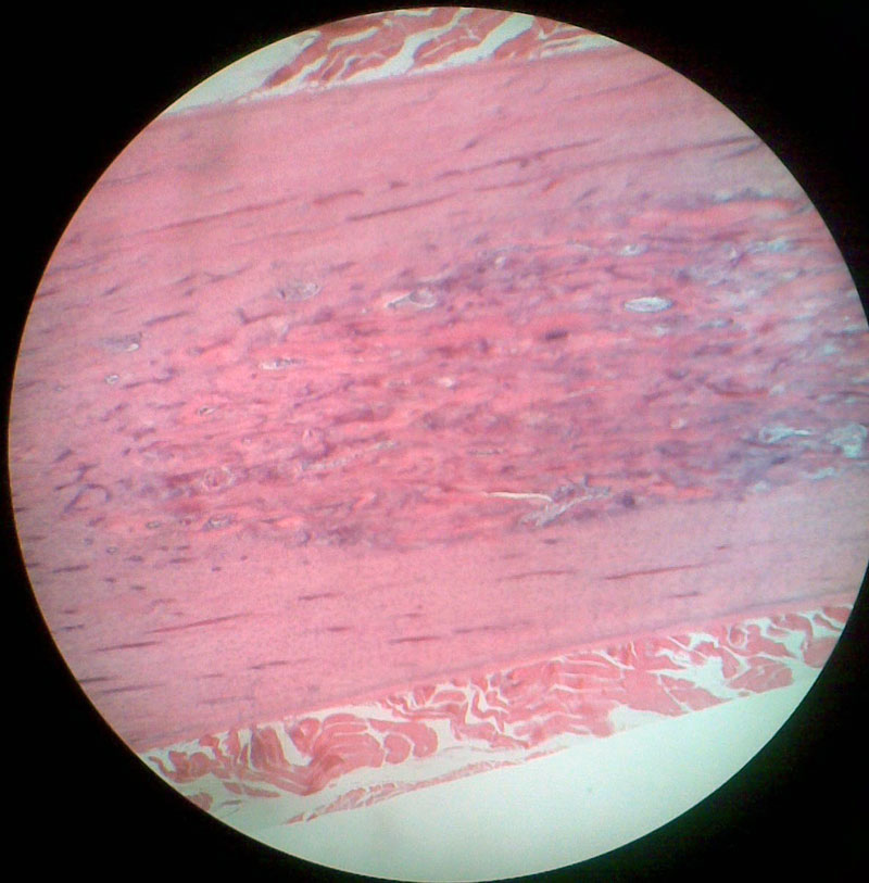 HowMed Images Medical Images For Easy Understanding
