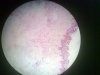 Keratinized squamous epithelium