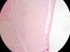 Hyaline cartilage -3