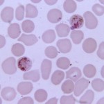 Plasmodium Malariae Schizont