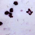 Plasmodium falciparum trophozoite