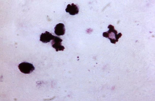Plasmodium falciparum trophozoite