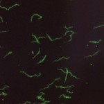 Treponema pallidum using indirect fluorescent antibody staining method