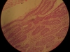 basal-cell-carcinoma-40x