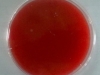 blood-agar-4
