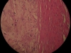 calcification-3smooth-muscle-40x