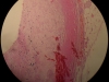 calcification-6-muscles-10x