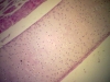 Hyaline Cartilage of Trachea