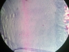 Fibrocartilage -1
