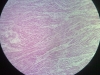 smooth-muscle-2