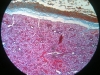 submandibular gland-1