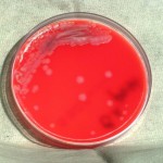 Bacillus anthracis colonial morphology