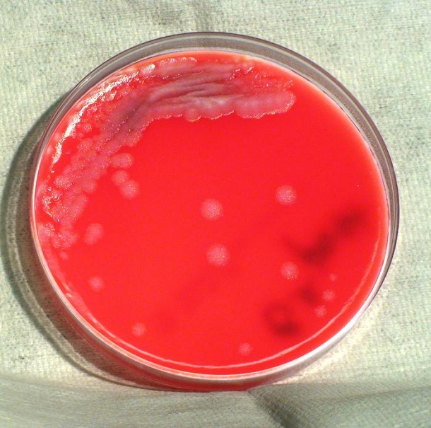 Bacillus anthracis colonial morphology