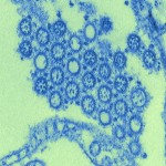 Novel flu H1N1 virus virions