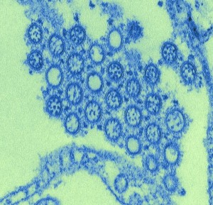 Novel Flu H1N1 (Swine Flu) Virus