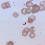 Plasmodium falciparum gametocyte