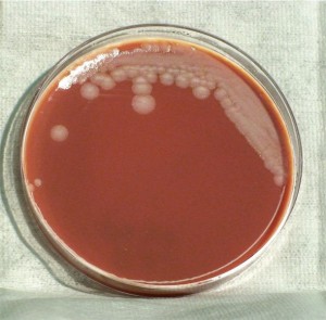 Bacillus Anthracis | howMed Images