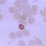 Plasmodium malariae trophozoite