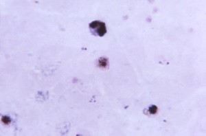 Plasmodium Vivax Gametocyte